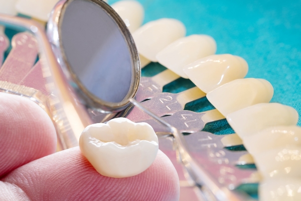 What To Do If You Damaged Your Dental Crown